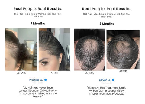 FEG PLUS Hair Growth Spray