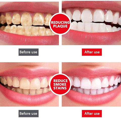 SP4 Toothpaste Ultra Whitening Toothpaste SP-4 Probiotics Whitening Toothpaste