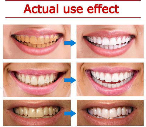 SP4 Toothpaste Ultra Whitening Toothpaste SP-4 Probiotics Whitening Toothpaste